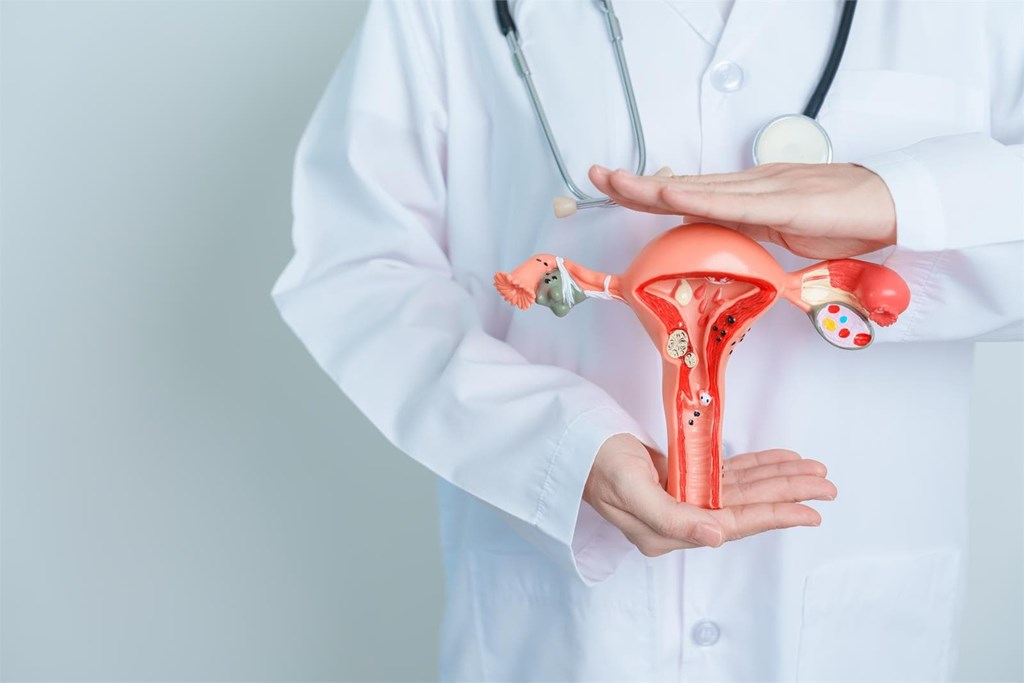 ¿Cómo detectar el cáncer de ovario a tiempo?