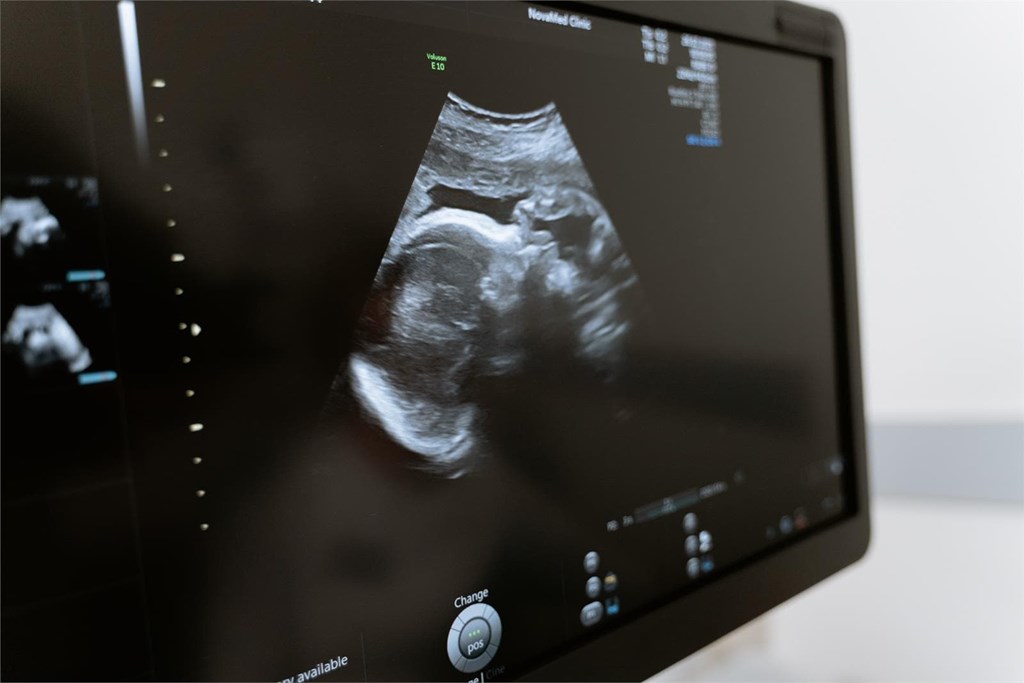 ¿Cuándo se hace la primera ecografía tras conocer el embarazo?